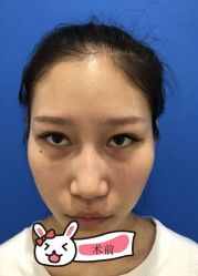 -广州健丽·去眼袋医疗美容机构