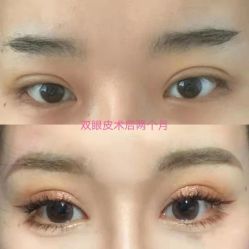 -上海漾颜医疗美容