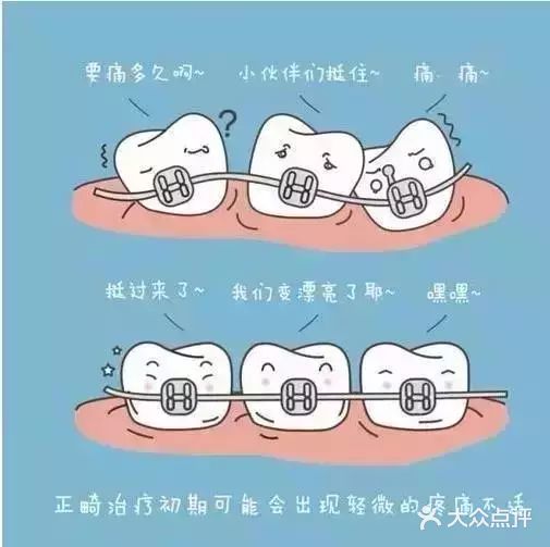 矫正牙齿担心的问题有很多，别担心都有答案！