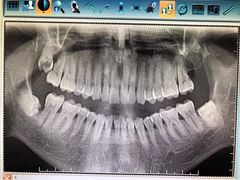 -天津市第三中心医院