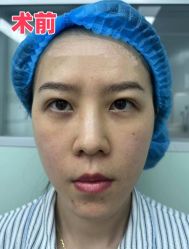 -素美医疗美容·西南眼鼻整形·修复基地