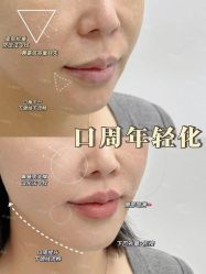 -深圳艺星医疗美容医院
