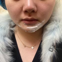 体验前-南京医科大学友谊整形外科医院