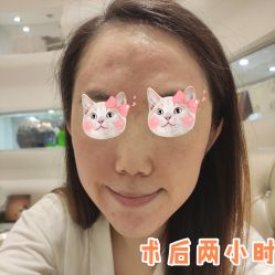 -洁铭新加坡医美