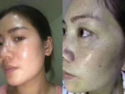 -苗方清颜专业祛痘