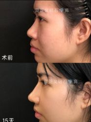-北京米扬丽格医疗美容·联合丽格鼻整形中心