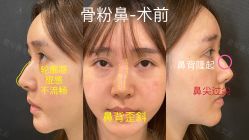 -北京米扬丽格医疗美容·联合丽格鼻整形中心