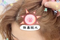 -大麦微针植发全国连锁