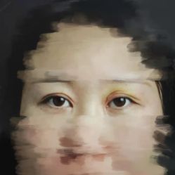 体验前-郑州米兰柏羽集美医疗美容医院