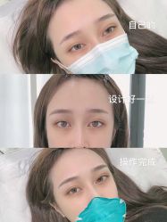 -久匠半永久纹眉