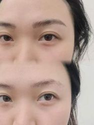 -西施无菌半永久纹绣眉眼影唇轻增发纹发际线