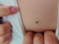 -中国人民解放军总医院