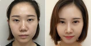 -SKINIST丽铂医疗美容
