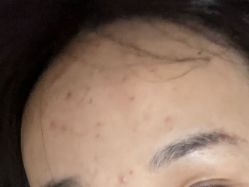 体验前-苏州卫康美容医院