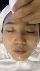 体验前-佳慕皮肤管理连锁