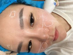 点击看大图 体验前-重庆联合丽格第五医疗美容医院