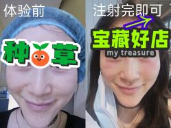 -天津健丽·去眼袋医疗美容机构