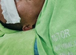 -苗医生0感祛痘连锁