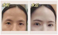 -素美医疗美容·西南眼鼻整形·修复基地