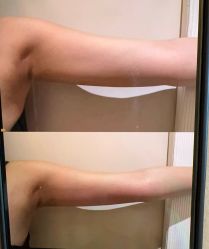 点击看大图 -栖SPA·ONDA ·美芙炫·海菲秀科技美肤中心