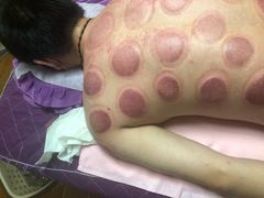-沈师傅盲人按摩工作室(密三小区店)