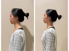 -FACE·日本小颜美容整骨(福田店)