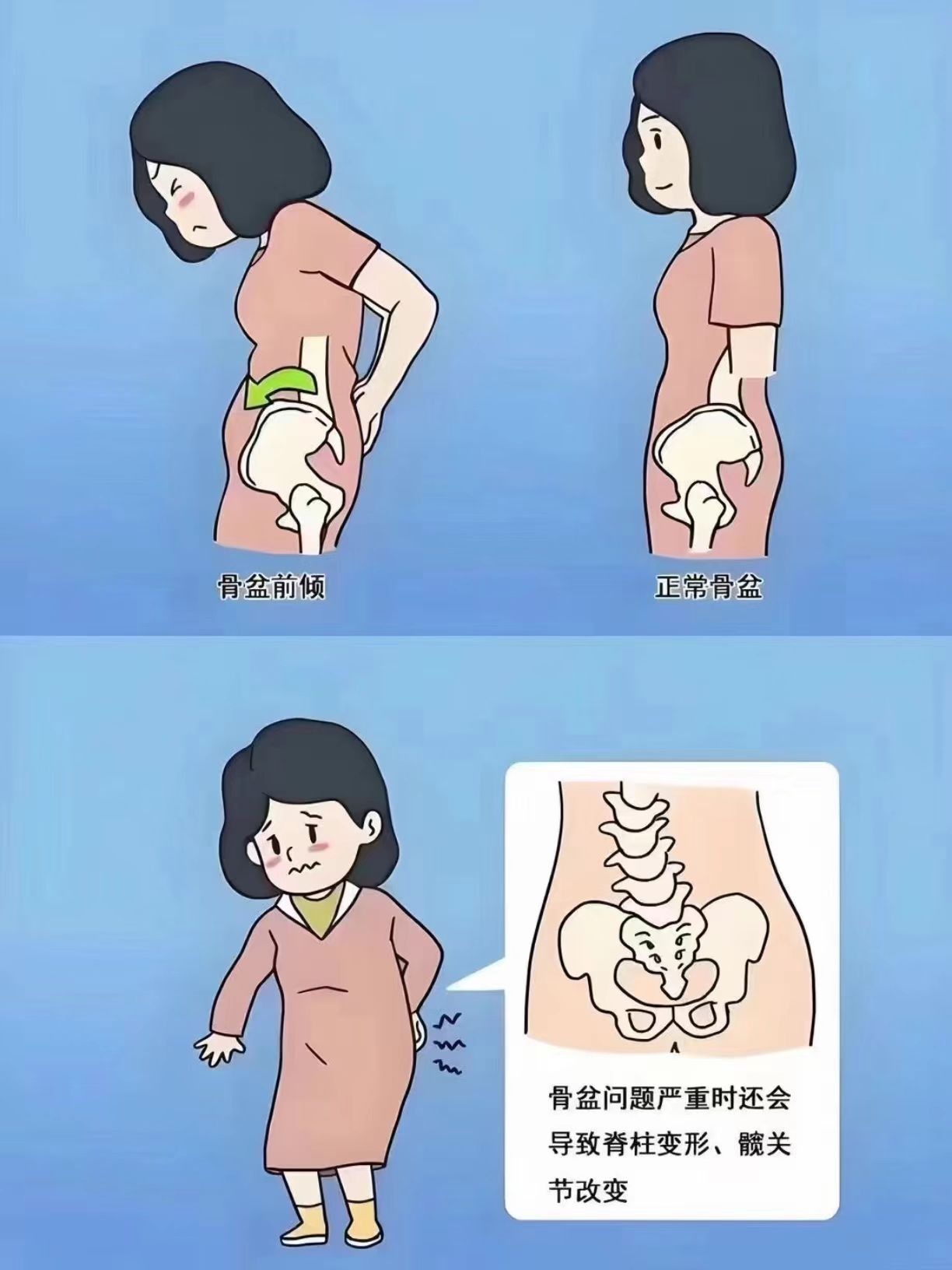 姐妹们,好好重视一下自己的骨盆
🥇