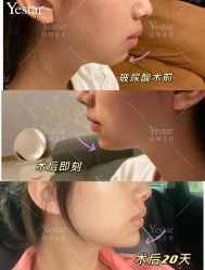 -Yestar艺星医疗美容医院