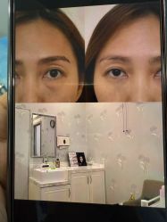 点击看大图 -广州健丽·去眼袋医疗美容机构