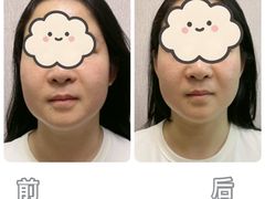 -修申骨雕小颜脊柱骨盆管理产后修复