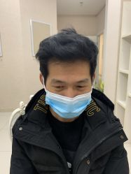 -大麦微针植发丨全国连锁