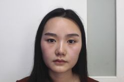 -成都西区医院整形美容