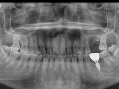 -牙博士口腔品牌连锁(杨浦店)