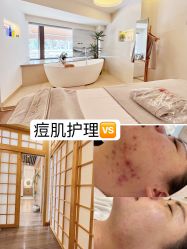 -宥莉·ULLY 痘敏肌•科技皮肤管理中心