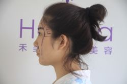 点击看大图 -禾美嘉医疗美容