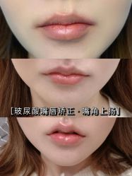 -上海漾颜医疗美容