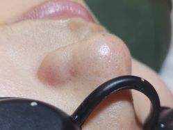 点击看大图 -Dr.Tin RooM美町美肤