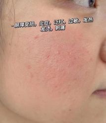 -美肤盾祛痘·问题肌头疗管理中心