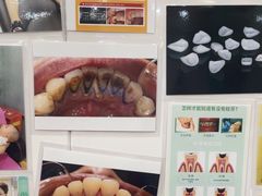 -爱齿尔口腔美学种植中心(永清院)