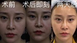 -深圳春天阳光医院·轮廓抗衰中心