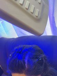 -碧莲盛·不剃发植发