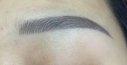 体验后-厦门美莱整形美容医院