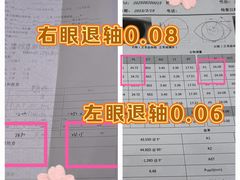 -上海大学附属上海和平眼科医院