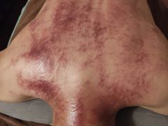 -御一坊盲人推拿(青年路店)