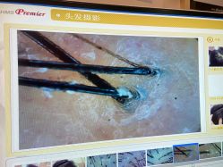 -丝客富脱发养发头皮馆