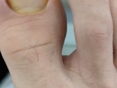 -世龙世家甲沟炎·灰指甲·嵌甲矫正·修脚(武侯区双楠店)