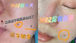 -圣嘉新医疗美容医院