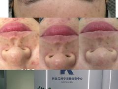 -上置·美兰优湖