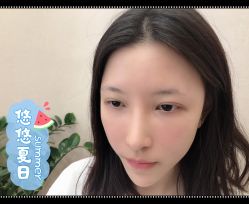 -大麦微针植发全国连锁