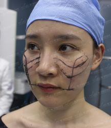 -厦门美莱整形美容医院